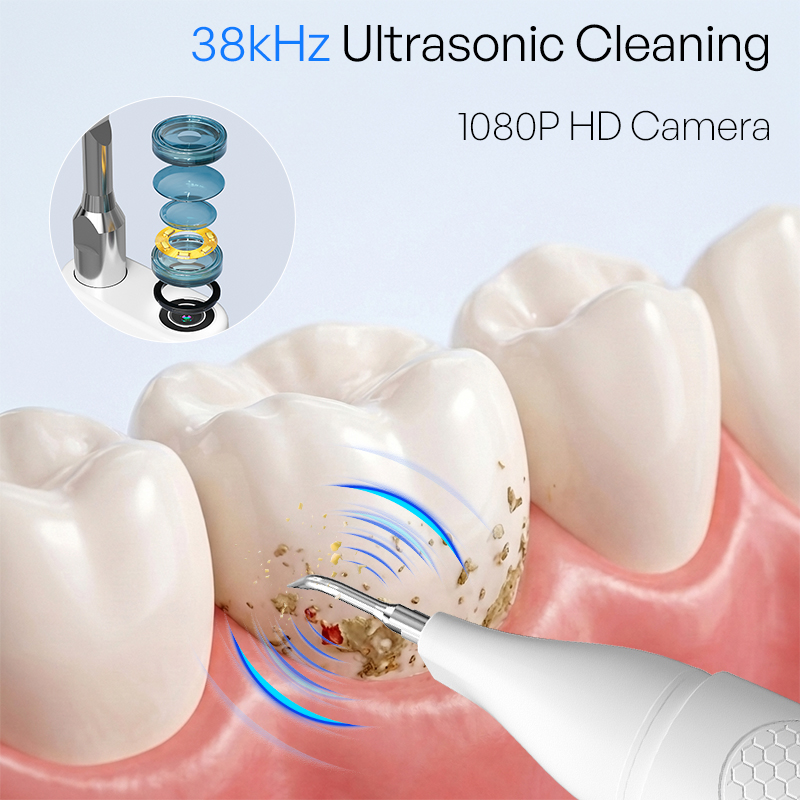 Pulitore Dentale a Ultrasuoni  - Teeth Whitening Mouthwash recensione e prezzo