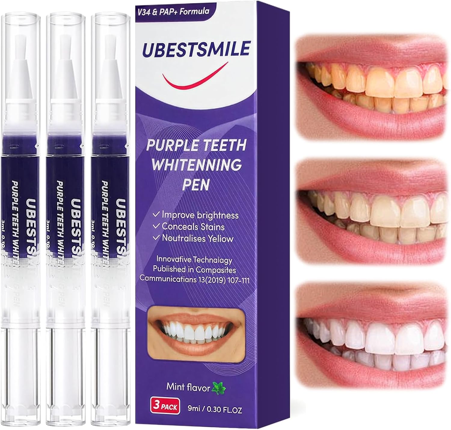 UBESTSMILE V34&PAP+ Formula Pe - Teeth Whitening Pens recensione e prezzo