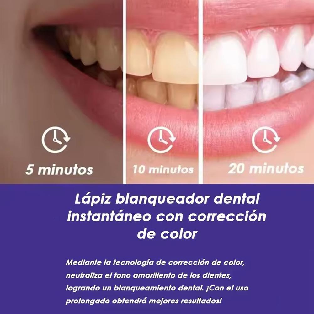 UBESTSMILE V34&PAP+ Formula Pe - Teeth Whitening Pens recensione e prezzo
