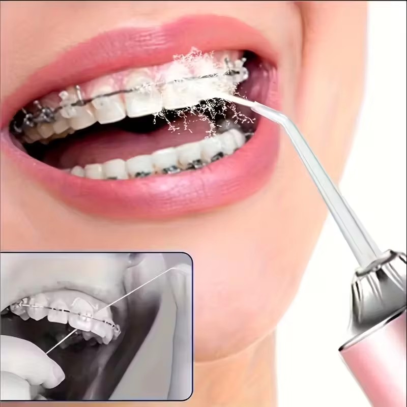Irrigatore Orale, Idropulsore  - Teeth Whitening Mouthwash recensione e prezzo